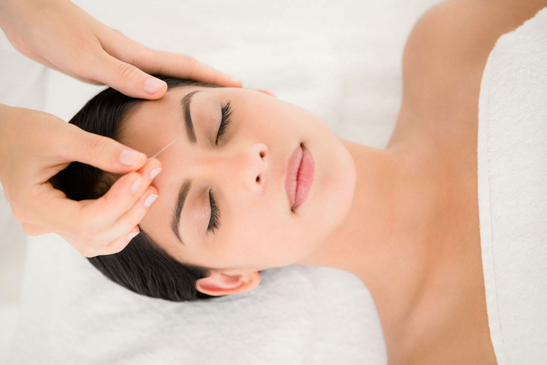 Acupuncture Therapy in Bangkok