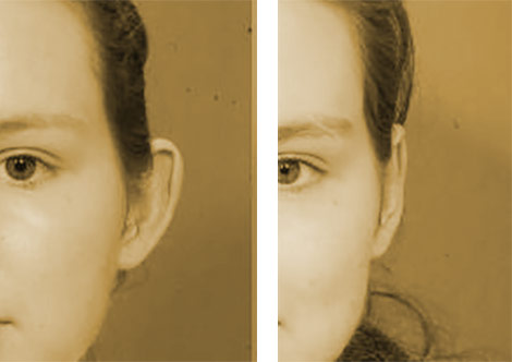 Ear Correction