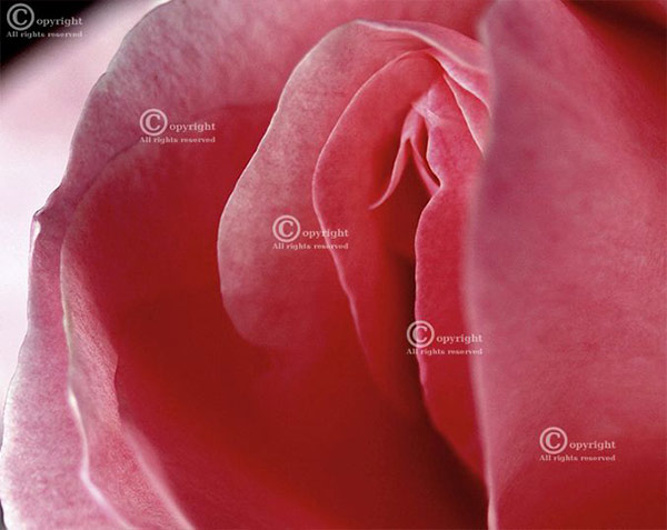Labia Majora Enhancement